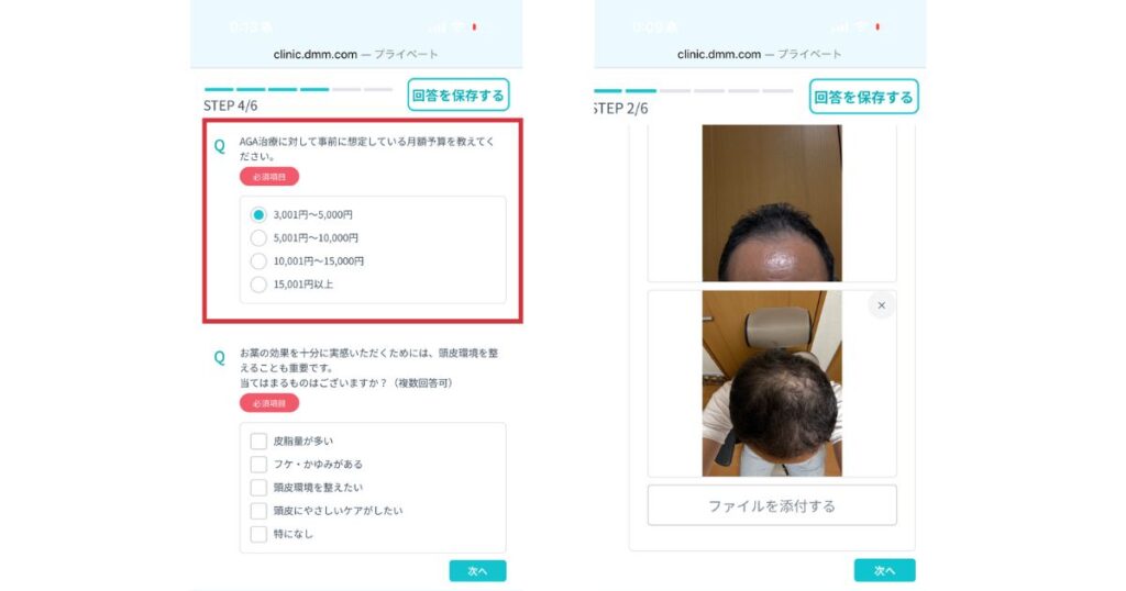 DMMオンラインクリニックの問診で頭部写真をアップロードしている画面