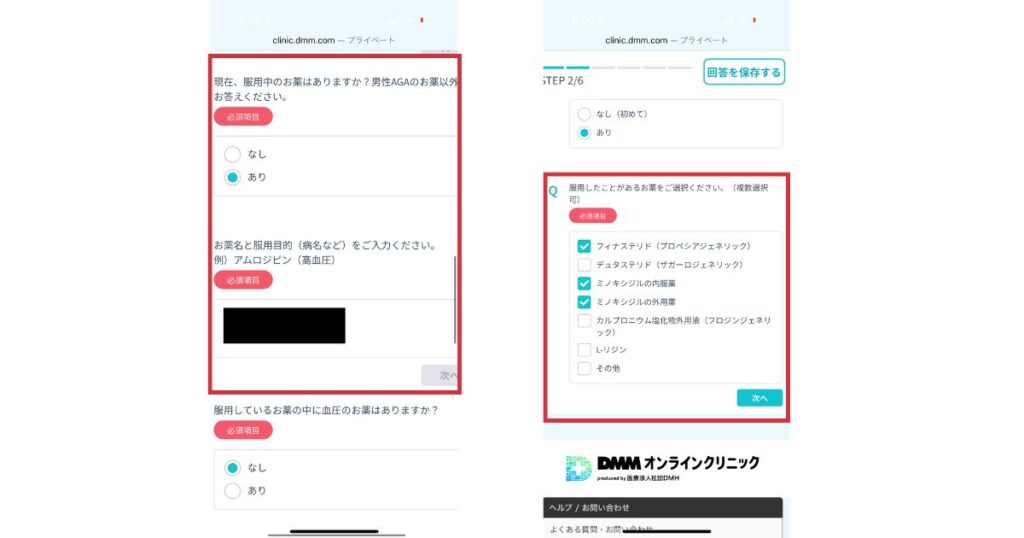 DMMオンラインクリニックの問診画面で服薬歴を選択している画面