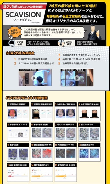 銀クリのスキャビジョン検査画面──2波長の紫外線で頭皮を600枚3D撮影しAIが15項目を分析している様子