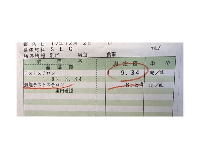 検査結果用紙の上部に、テストステロン9.34 ng/mLと遊離テストステロン8.8 pg/mLの測定値が記載されている。